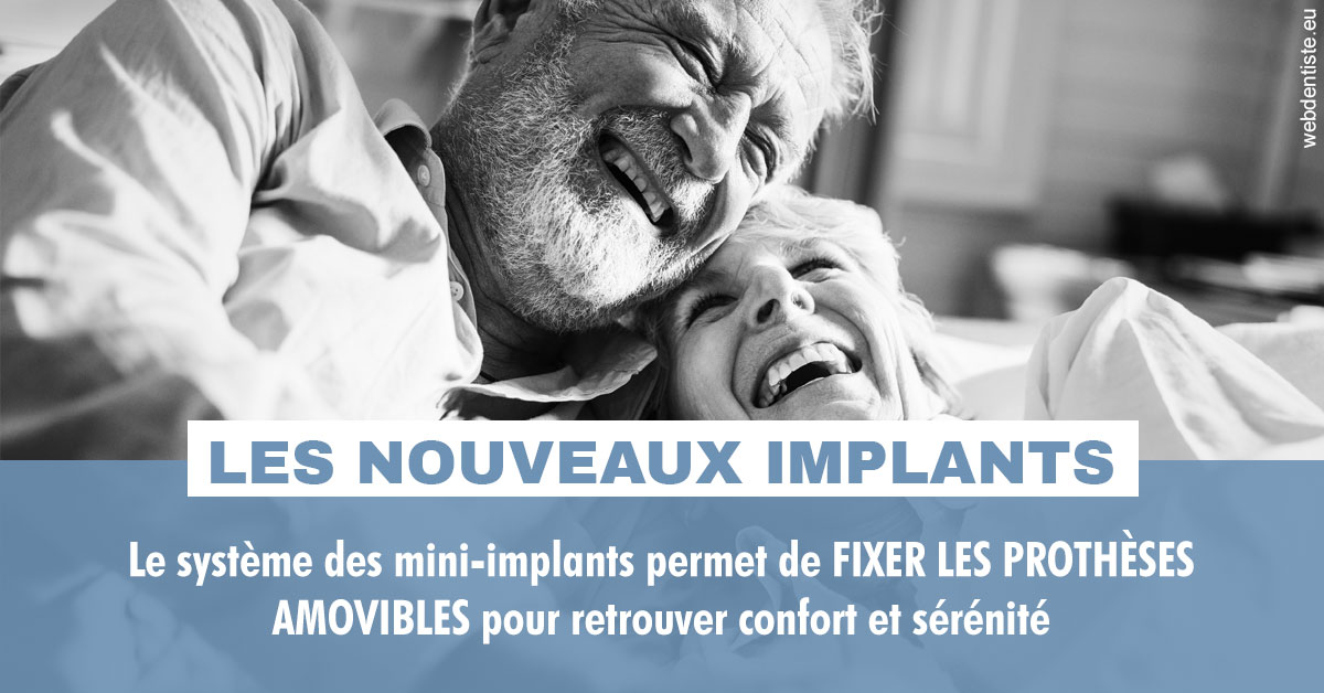https://dr-pichon-denis.chirurgiens-dentistes.fr/Les nouveaux implants 2