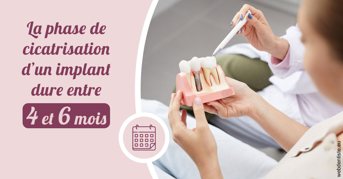 https://dr-pichon-denis.chirurgiens-dentistes.fr/Cicatrisation implant 2
