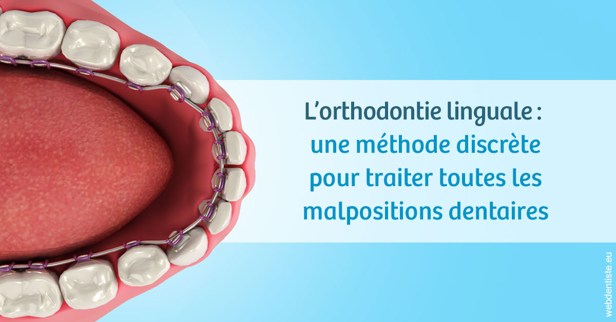 https://dr-pichon-denis.chirurgiens-dentistes.fr/L'orthodontie linguale 1