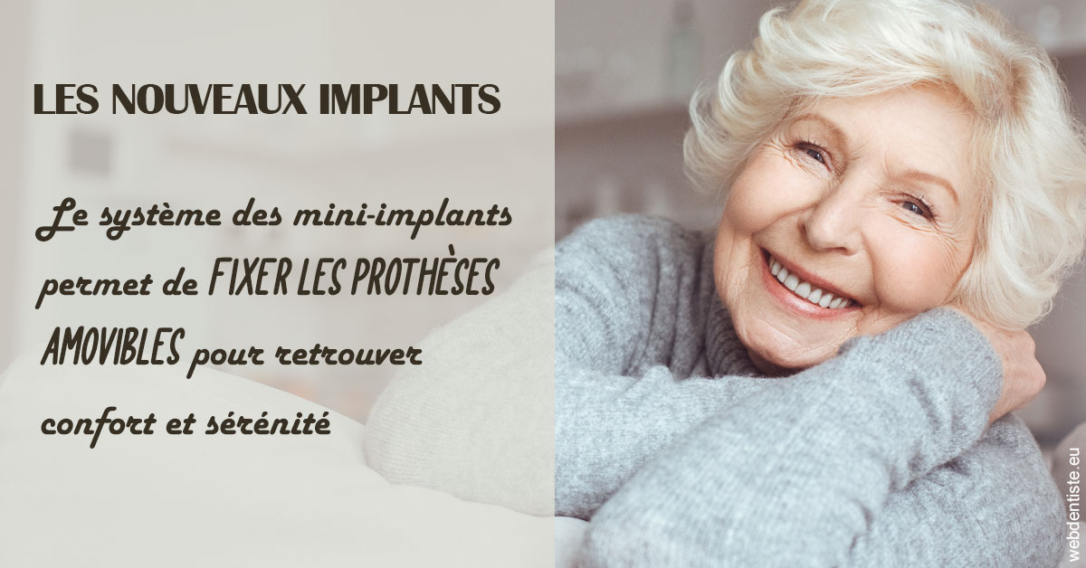 https://dr-pichon-denis.chirurgiens-dentistes.fr/Les nouveaux implants 1