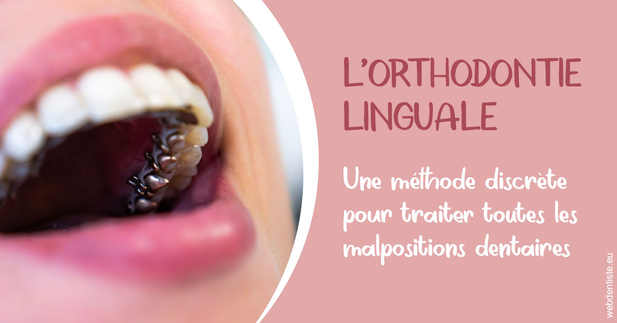 https://dr-pichon-denis.chirurgiens-dentistes.fr/L'orthodontie linguale 2