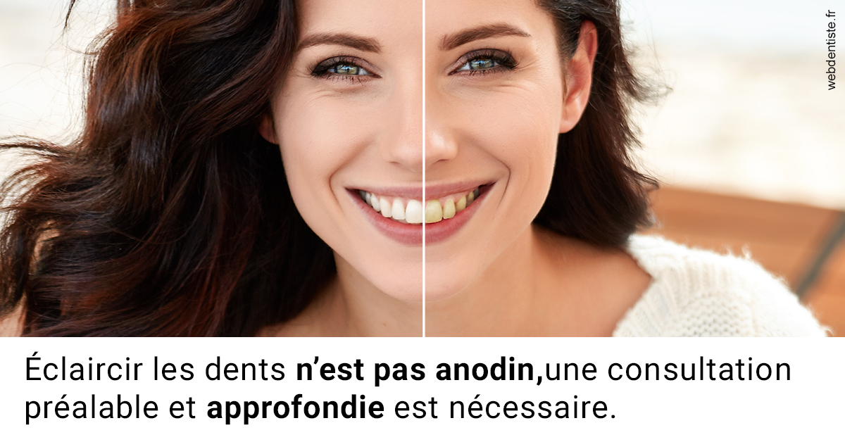 https://dr-pichon-denis.chirurgiens-dentistes.fr/Le blanchiment 2