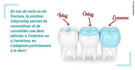 https://dr-pichon-denis.chirurgiens-dentistes.fr/L'INLAY ou l'ONLAY