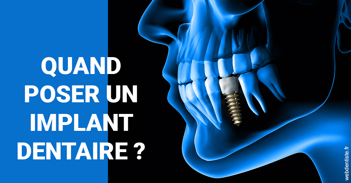 https://dr-pichon-denis.chirurgiens-dentistes.fr/Les implants 1
