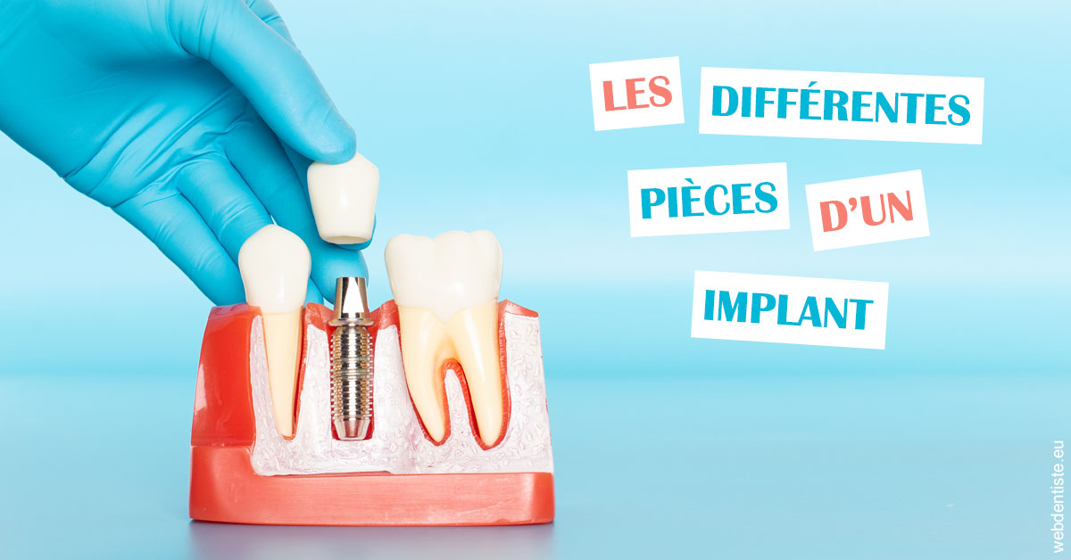 https://dr-pichon-denis.chirurgiens-dentistes.fr/Les différentes pièces d’un implant 2