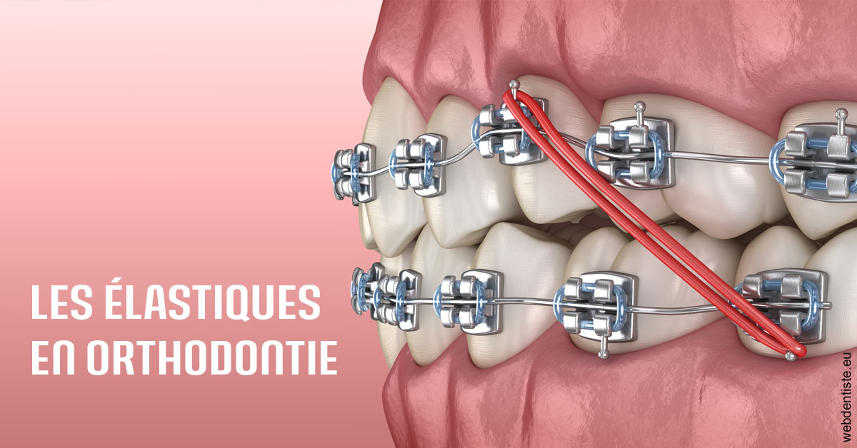 https://dr-pichon-denis.chirurgiens-dentistes.fr/Elastiques orthodontie 2