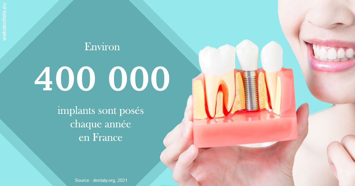 https://dr-pichon-denis.chirurgiens-dentistes.fr/Pose d'implants en France 2